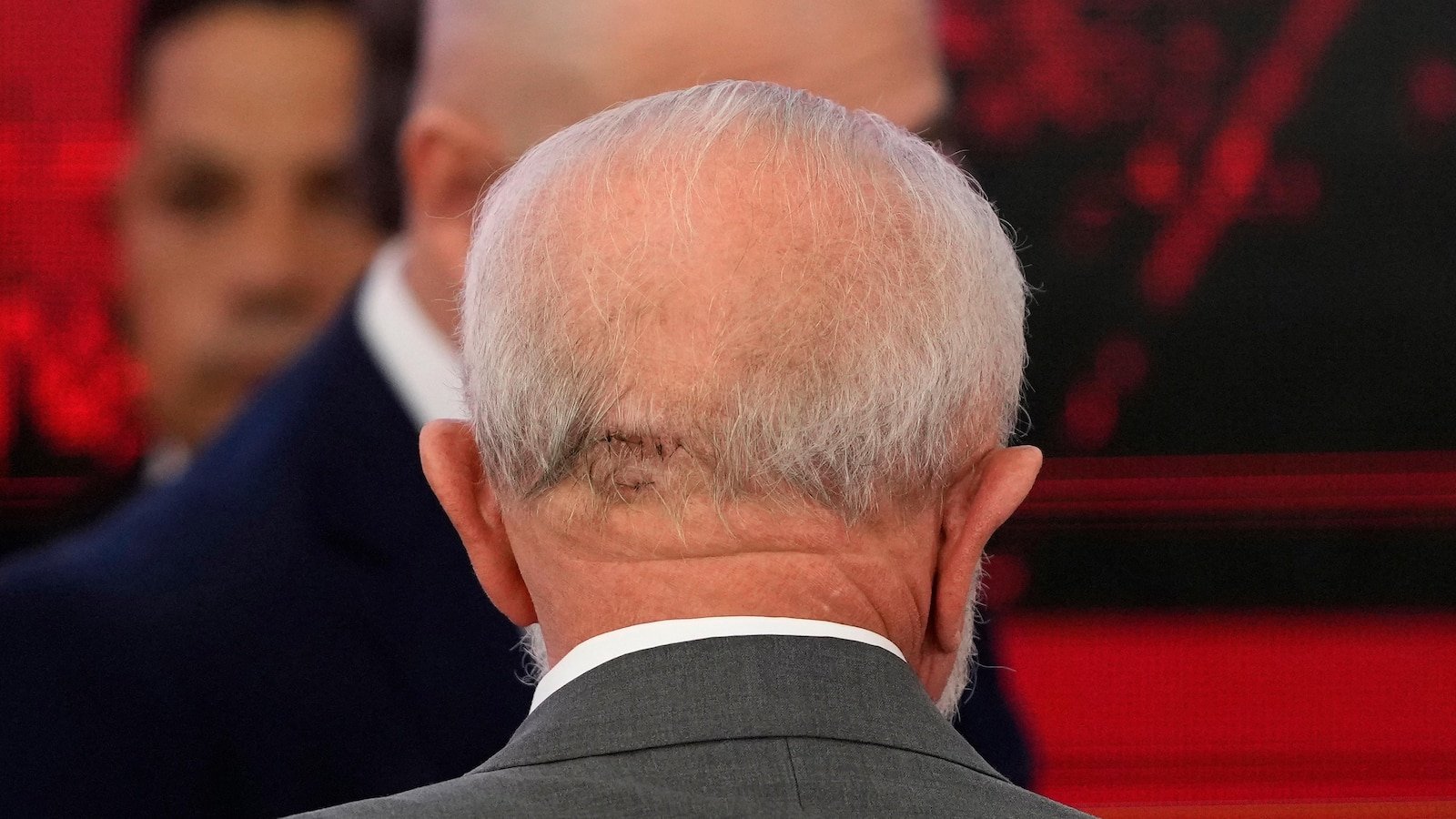 brazil’s-lula-undergoes-a-second-procedure-to-stop-brain-bleed